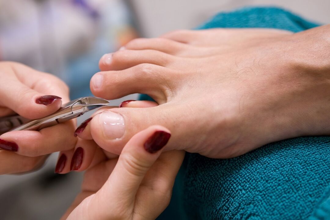 pedicures as a way to infect nail fungus