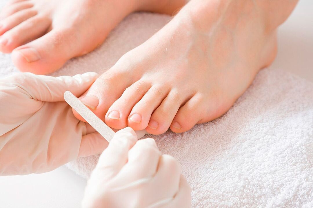 effective treatment of nail fungus with varnish