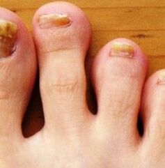 Nog feet
