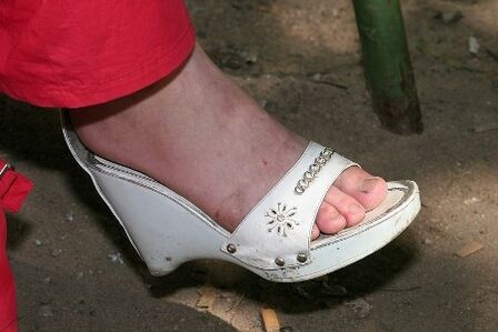 skin dry on the feet